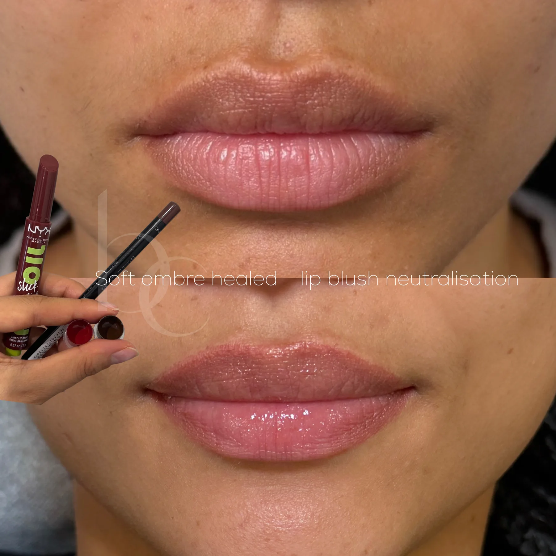 Healed lip blush neutralisation result with pigments